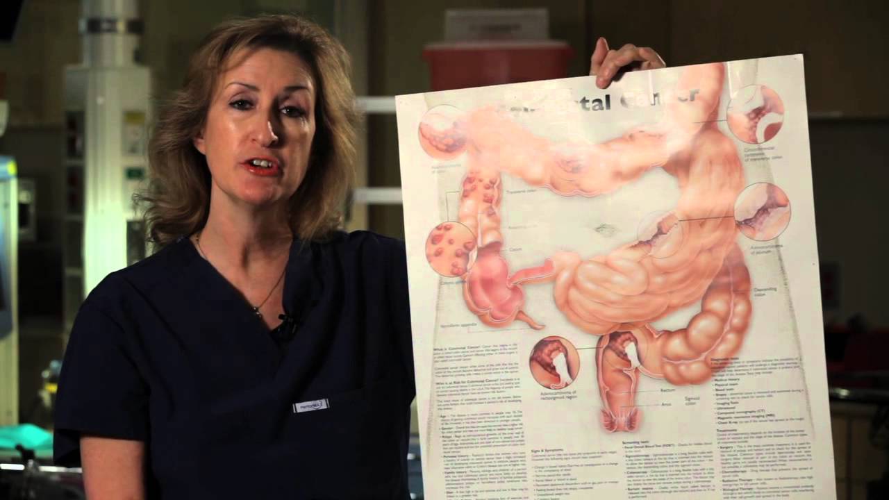 Doctor presenting medical information in an educational video using a colon diagram